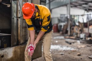 WORKER SUFFERING PERSONAL INJURY TO HIS HAND