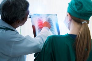 A doctor and a nurse look at an lung cancer x-ray