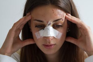 A woman looking distressed with a bandage over her broken nose.