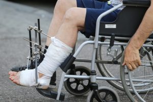 A person sits in a wheelchair with a bandaged foot. 