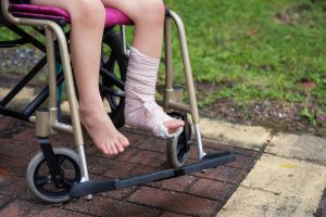 A person in a wheelchair with a broken foot in a cast 